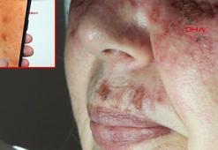 'Aşırı makyaj ve kozmetik yüzünden cilt bariyeri 18'li yaşlarda çöküyor’