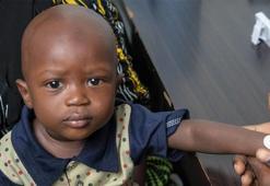 Gambia’da yürütülen mikro iğneli bant aşı testinin sonuçları başarılı