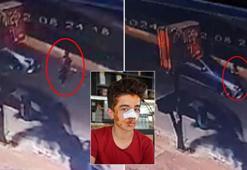 Köpeklerden kaçarken otomobilin çarptığı çocuk yaralandı; kaza kamerada