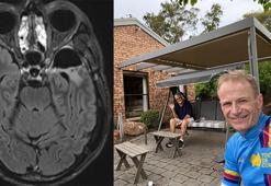 Avustralyalı doktor, beyin kanserini kendi çalışmasıyla tedavi etti