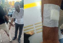 İşe giderken köpeklerin saldırısında yaralandı