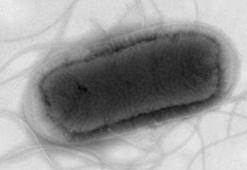 İngiltere’de gıdadan koli basili salgını: 113 vaka