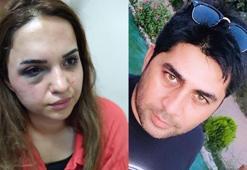 Bir yıldır boşanmak istediği eşi darbedip, bıçakladı