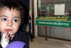 13 yaşındaki Mert, kelebek hastalığından öldü