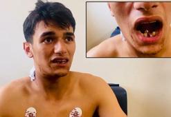 Pendik'te boynundan giren mermi çenesine saplandı