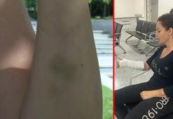 Maltepe'de Sokak hayvanlarını beslediği için darp edilen akademisyen yaşananları anlattı