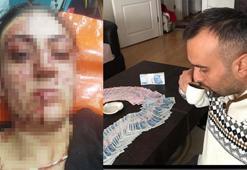 Sinem'i 7 yerinden bıçaklayan eski eşine 9 ayda tahliye