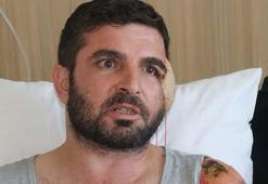 Çocuklarını kurtarmak için otomobilinin önüne atladı; yaralanan yüzüne bacağından doku nakli yapıldı