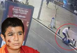 Yaya geçidinde otomobiliyle çarptığı Oğulcan'ı hastaneye bırakıp kaçtı