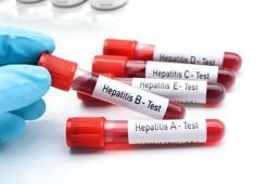 “Birinci derece yakınlarında hepatit olanlar mutlaka taramadan geçmeli"