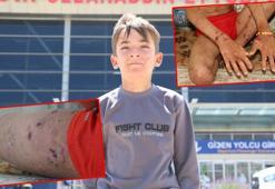 DHA haber yapmıştı; Amar, Ankara'da tedavi olacak