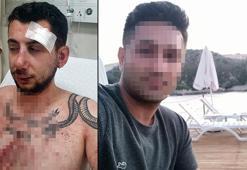 Eski sevgilisinin arkadaşına muştayla saldırıp çenesini kıran sanığa, 'iyi hal' indirimiyle 6 yıl hapis