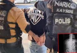 Midesinde taşıdığı 1 kilo uyuşturucuyla yakalandı