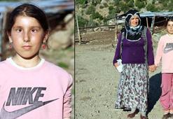 Şeker hastalığından gözleri kapanan Sudenaz, görmek istiyor