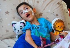 Hidrosefali hastası Osmancan, yaşından çok ameliyat geçirdi