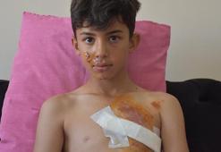 Duvarda açıkta kalan inşaat demiri, Gürkan'ın göğsüne saplandı