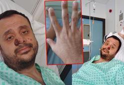 DSÖ'nün 'Farkındalık yüzü' Harun Tulunay : HIV'le hiç sorun yaşamadım ama Mpox ızdırabım oldu