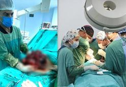 Yıllarca karnındaki 10 kiloluk kitleyle yaşamış