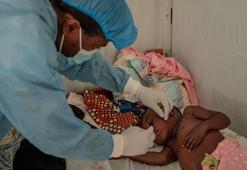 USAID, maymun çiçeğinden etkilenen bölgelere 35 milyon dolarlık yardım sağlayacak