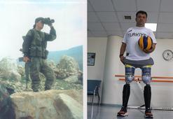 Terör gazisi, mikroişlemcili diz proteziyle desteksiz yürüyor