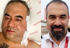 Pilotun ameliyatta ölümünde, 'doktor ihmali' iddiası