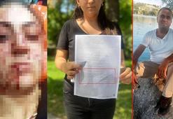 Sinem'e, kendisini bıçaklayan eski eşine çocuklarını göstermediği gerekçesiyle hapis cezası