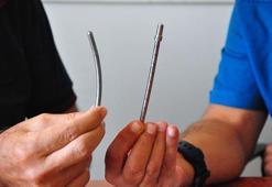 Yerli ve milli elastik rod üretildi; skolyoz hastalarında omurga hareketlerini kısıtlamıyor