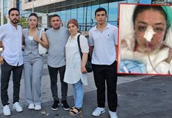 Şaka yapayım derken 2 iş arkadaşının yanmasına sebep olan hemşireye 3,5 yıl hapis