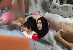 Bakımevinde şiddet gördüğü öne sürülen çocuğun annesi: Bakımevi değil korku evi
