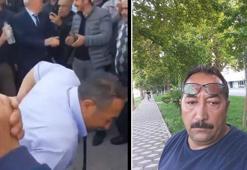 ‘Topal’ şarkısı yüzünden yaralama sanıklarına 15'er yıla kadar hapis istemi