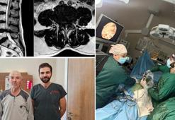 Erbaa ilk kez kapalı yöntemle bel fıtığı ve kanal daralması ameliyatı yapıldı