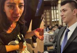 Kırşehir'de genç kızın burnunu kıran AK Parti Keskin Gençlik Kolları Başkanı Ünlüer, serbest bırakıldı