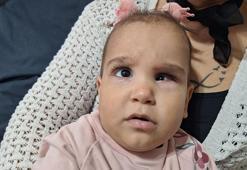 Yenidoğan Çetesi’nin ihmali, 3 kardeşi ölen Cemre bebeğin kör olmasına sebep oldu
