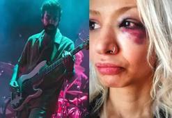 Yüzyüzeyken Konuşuruz'un gitaristinin sevgilisini darbettiği iddiasına ilişkin davada karar çıktı