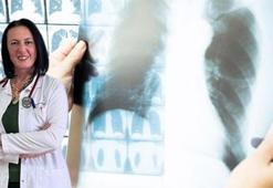 'Son 1 yılda 31 bin kişi akciğer kanseri tanısı aldı'