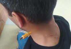 Esenyurt'ta park yeri kavgasında boynuna tornavida sapladı