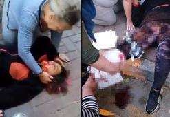 Yürüyüşe çıkan profesör, köpeklerin saldırısında yaralandı