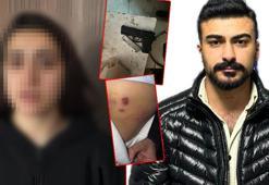 Sarıyer’de eski sevgili dehşeti; evi basıp aileye kurşun yağdırdı