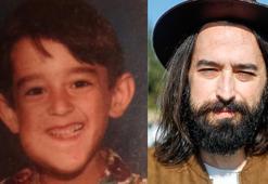 Yüzündeki tümör yalnızlığa itti, kendini müziğe adayıp müzisyen oldu