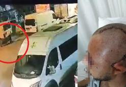 Parkta içki içen çalışanını sopayla dövmekle suçlanan patrona 15 yıl hapis istemi