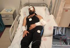 Silahlı kavgada yaralanan dernek başkanı: Daha önce kuzenimi öldürüp, beni bıçakladılar