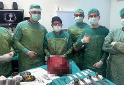 Karnından 13 kiloluk kitle çıkarıldı