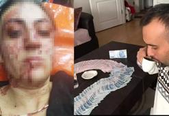 Sinem'i 7 yerinden bıçaklayan eski eşine 20 yıla kadar hapis talebi