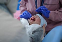 Dudak damağı yarığıyla dünyaya gelen Muhamed bebek için tedaviye başlandı
