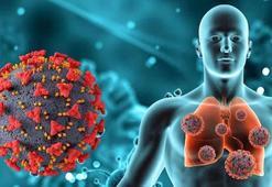 Uzmanından 'HMPV' açıklaması: Türkiye'de anormal durum yok