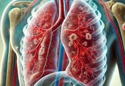 Prof. Dr. Özlü: Verem hastalığının teşhisi kolay, tedavisi de var