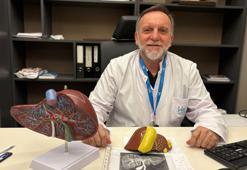 'Enginar, devetabanı ve kahve tüketimi karaciğer sağlığı için önemli rol oynuyor'