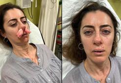 Kendisini eşinin sevgilisi zanneden kadın tarafından darbedildi