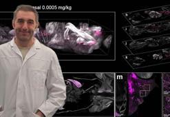 Prof. Dr. Ertürk: Kanser tedavisinde yan etkiler ortadan kalkabilir