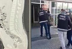 Yabancı uyruklu yolcunun midesinden 219 paket uyuşturucu çıktı